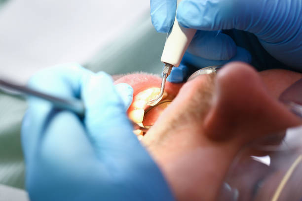 Best Walk-In Emergency Dentist in Zanesville, OH